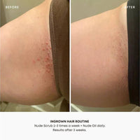 Watermelon Sugar Ingrown Hair Oil (30 ml-1 oz)