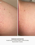 Nude Ingrown Hair Oil