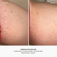 Watermelon Sugar Ingrown Hair Oil (30 ml-1 oz)
