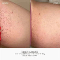Nude Ingrown Hair Oil & Scrub 2 Step Routine