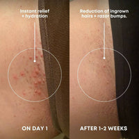 Sweet Escape Ingrown Hair Oil & Scrub 2 Step Routine