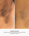 Bermuda Ingrown Hair Oil - Dark Spot