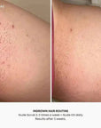 Nude Ingrown Hair Oil & Scrub 2 Step Routine