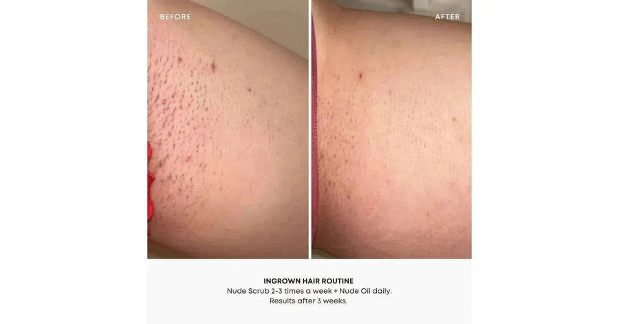 Nude Ingrown Hair Oil & Scrub 2 Step Routine