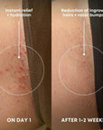 Sweet Escape Ingrown Hair Oil & Scrub 2 Step Routine