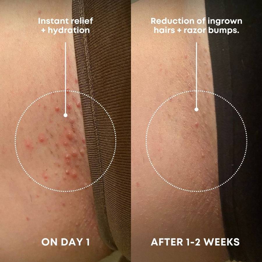 Sweet Escape Ingrown Hair Oil & Scrub 2 Step Routine