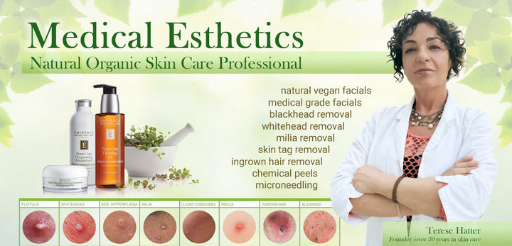 Milia removal Toronto Ontario Beauty Tree