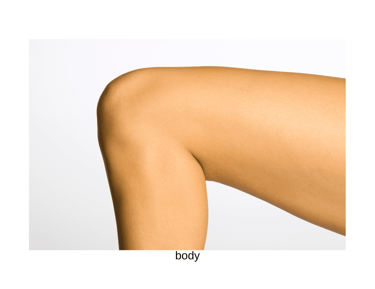 Smooth skin on leg after body chemical peel